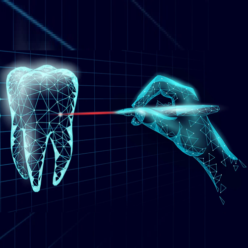 Dental Laser