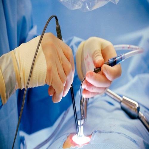 Surgical Gynaecology